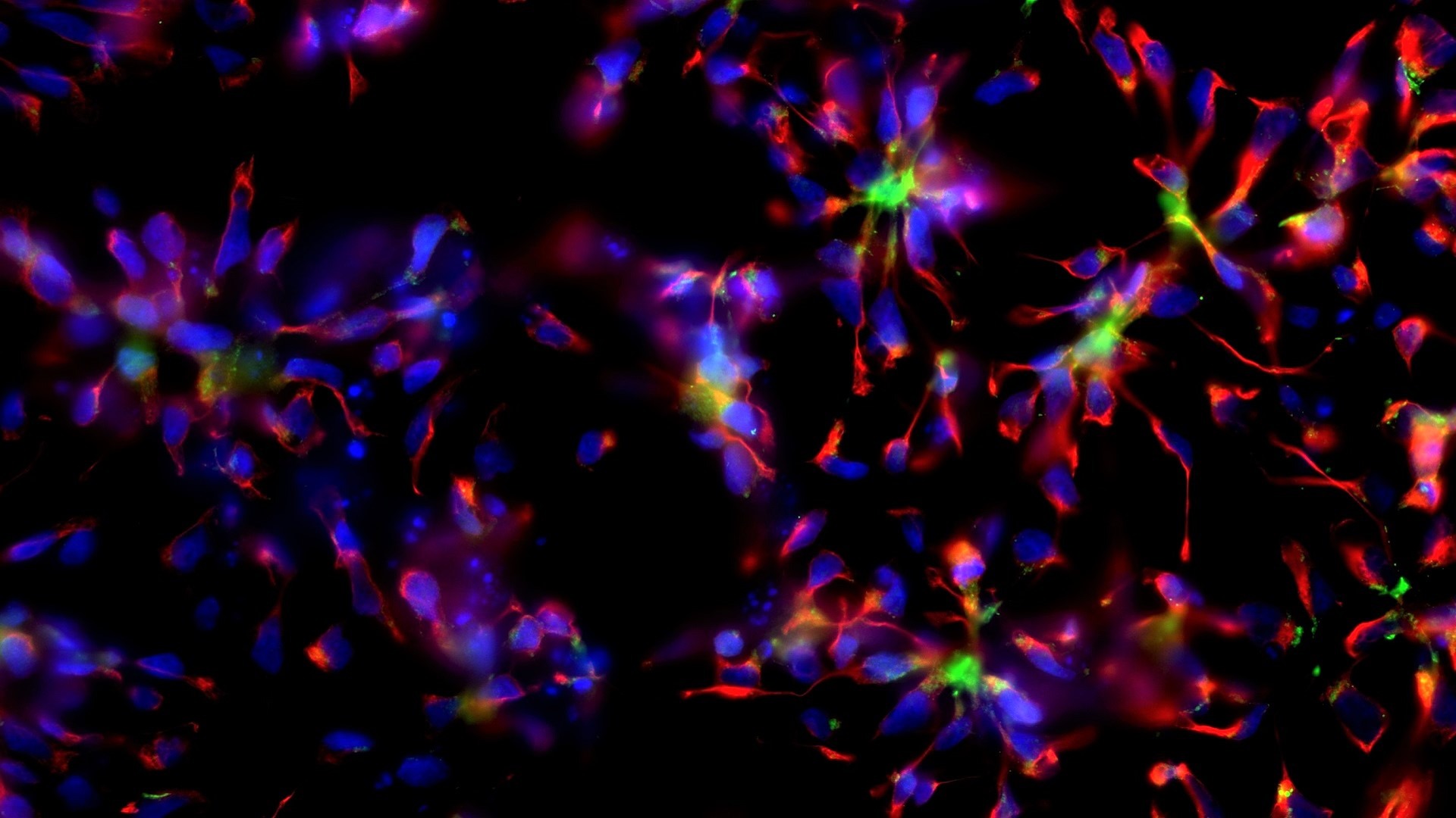 immunofluorescence de neuroprogeniteurs formant des rosettes, a kind of cell bouquet. En rouge Nestin et vert N-cadherin