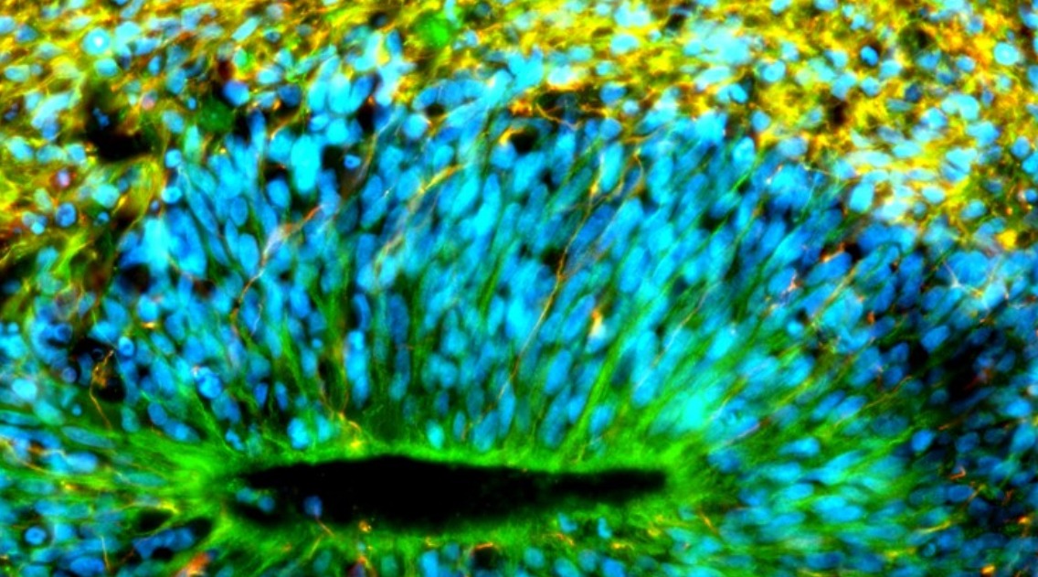 CBP-HSF2 structural and functional interplay in Rubinstein-Taybi neurodevelopmental disorder
