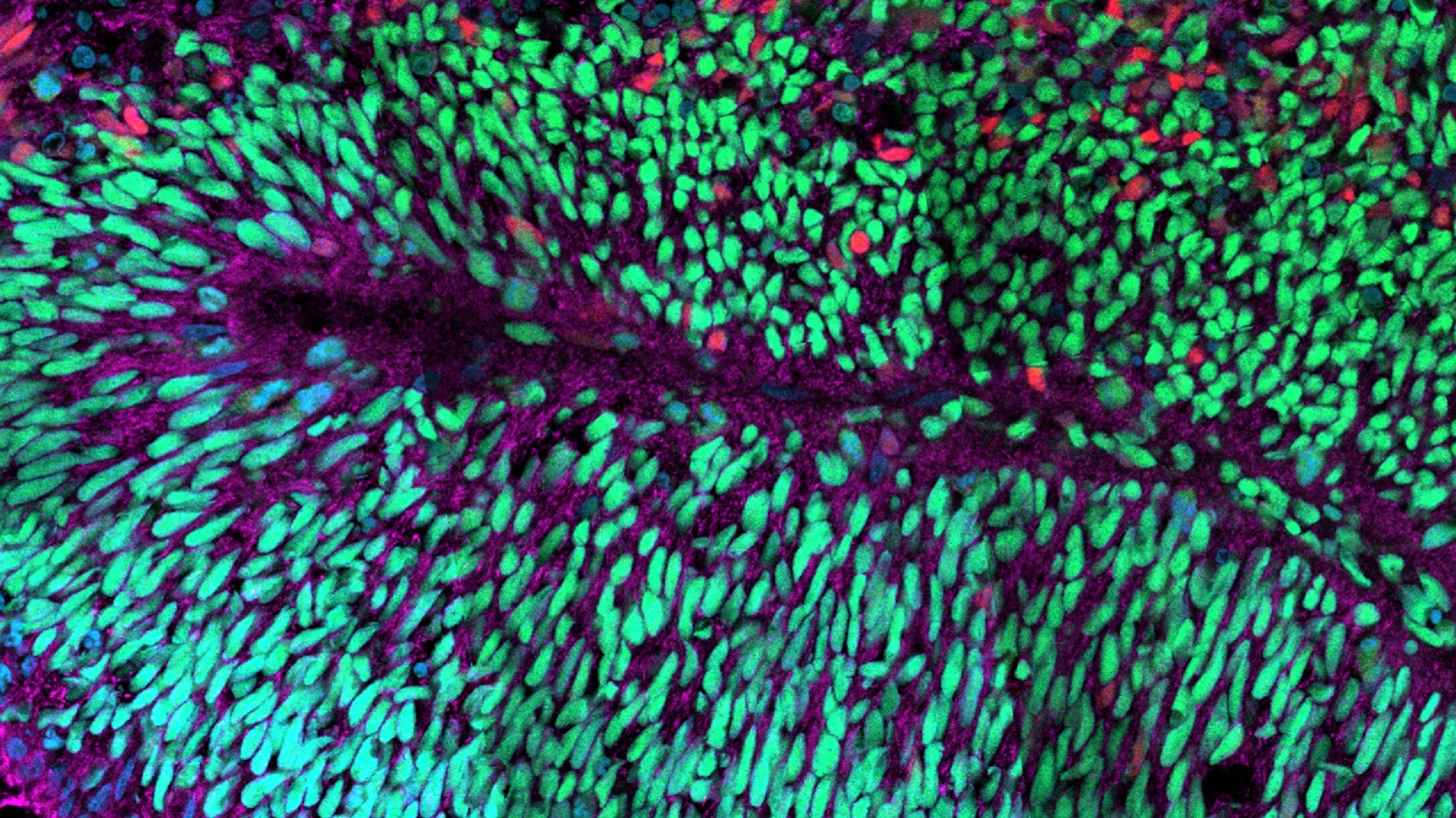 image d'une coupe d'organoide cérébral humain, immunomarqué
