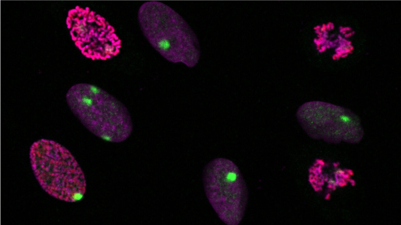 Dynamic Profiling Polo group | Epigenetics