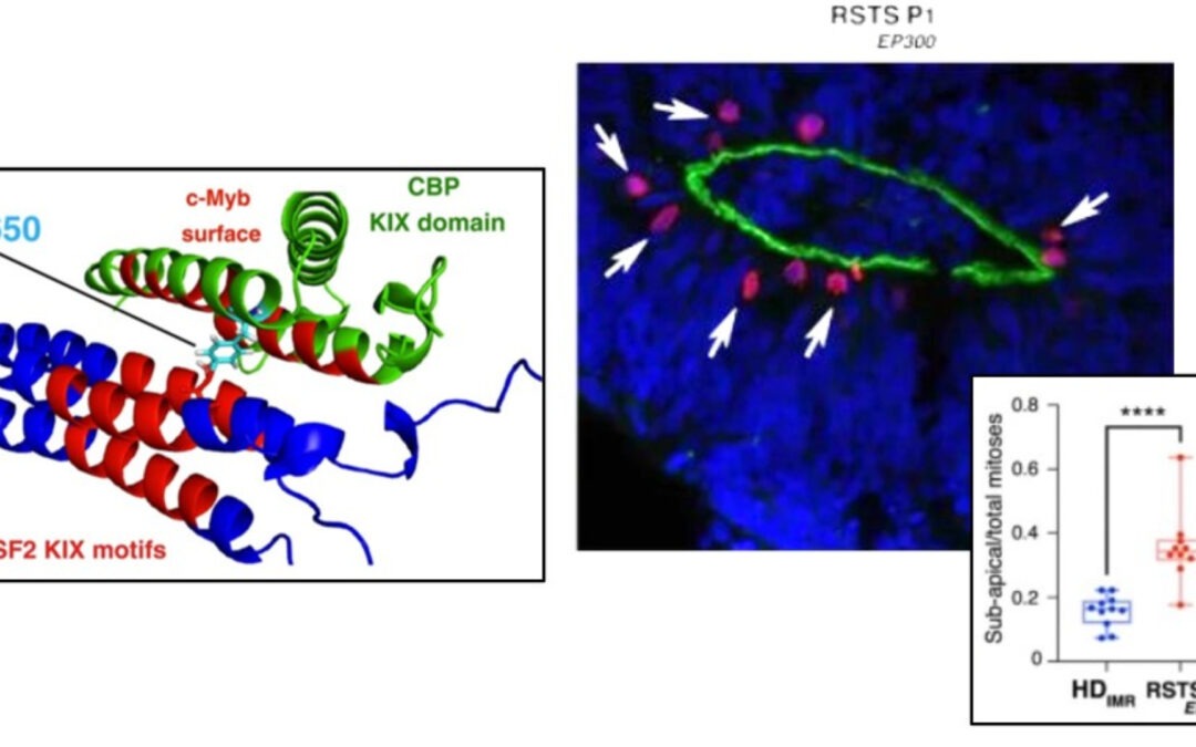 CBP-HSF2 structural and functional interplay in Rubinstein-Taybi  neurodevelopmental disorder